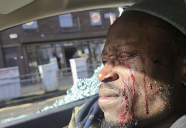 Nigerian Dancer Tobi Omoteso in Ireland Loses Vision After Brutal Road Rage Attack