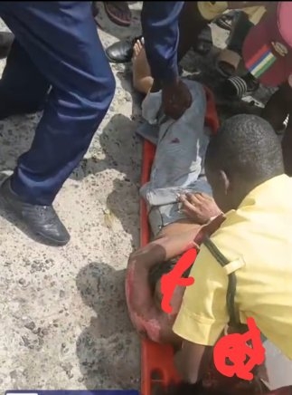 Woman Suffers Fractures in Lagos Hit-and-Run Incident as Driver Flee